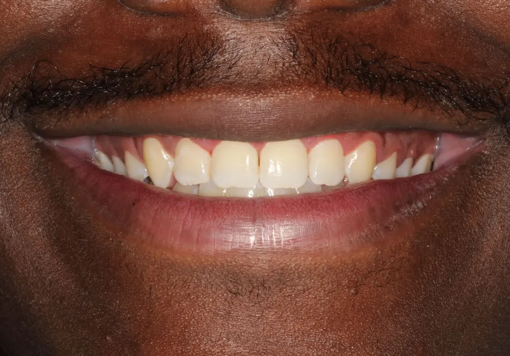 Close-up of a healthy smile